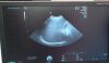 GE C2-9-RS Ultrasound Transducer