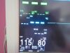NIHON KOHDEN Patient Monitor Spo2 ECG NIBP Temp Bedside Monitor