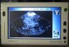 MCUBE BIOCON Portable Ultrasound Bladder Scanner w/ Probe Ultrasound - Urology