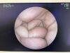 FUJI Sapientia VP-4400, XL-4400 Endoscopy Processor