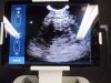 ECHONOUS System POCUS Urological Instrument