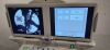 OEC 9900 "SUPER C" "PM CARES" C-Arm