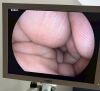 FUJI EG-L580NW Gastroscope