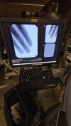 ZIEHM quantum C-Arm