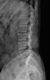 KONICA installation, Chiropractic X-ray