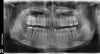 SCNX 076783016996 Dental Digital Imaging
