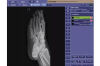 HIGH FREQUENCY PXS-710D Podiatric X-Ray