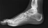 20/20 IMAGING Digital Podiatric X-Ray