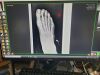 20/20 IMAGING Digital Podiatric X-Ray