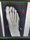 20/20 IMAGING Digital Podiatric X-Ray
