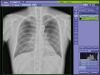 SOURCE Mobile Art Portable X-Ray