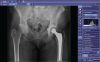 SOURCE Mobile Art Portable X-Ray