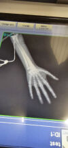 MOBILE DIGITAL IMAGING Ray Portable X-Ray