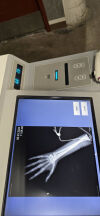 MOBILE DIGITAL IMAGING Ray Portable X-Ray