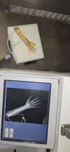 MOBILE DIGITAL IMAGING Ray Portable X-Ray