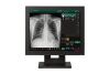 SOURCE Digital Portable Portable X-Ray