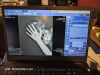 SOURCE Portable Portable X-Ray