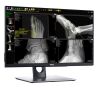CARESTREAM 2021 Portable X-Ray