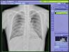 SHIMADZU mux 200D Portable X-Ray
