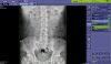SHIMADZU mux 200D Portable X-Ray