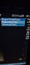 FUJI S cath musculoskeletal  ultrasound machine portable  2015