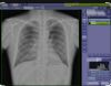 SHIMATZU Mobile Art Evolution Portable X-Ray