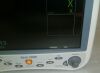 GE Dash 5000 Monitor
