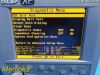 ASPECT MEDICAL A-2000 Bis-XP, W/ DSC-XP Module & Interface Cable ~ Monitor