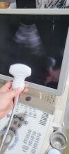 MEDISON Accuvix V10 Ultrasound - Cardiac - Vascular