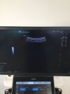 GE Logiq E10 Ultrasound - Vascular - Small Parts