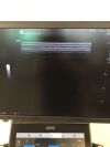 GE Logiq E10 Ultrasound - Vascular - Small Parts