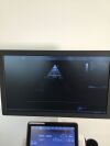 GE Vivid T9 Ultrasound - Cardiac - Vascular