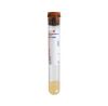 VACUETTE BD-367988 BD Vacutainer® SST™ Venous Blood Collection Tube Clot Activator / Separator Gel Additive 8.5 mL Conventional Closure Plastic