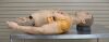 TACMED Trauma F/X APL-PB AirwayPlus Lifecast Pulses/Breathing 1000 Series - 209132 Trauma Unit