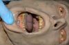 TACMED Trauma F/X APL-PB AirwayPlus Lifecast Pulses/Breathing 1000 Series - 209132 Trauma Unit