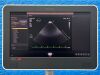 PHILIPS EPIQ 7C, YOM: 2016 with Probe  X5-1 Ultrasound