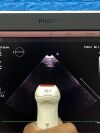 PHILIPS EPIQ 7C, YOM: 2016 with Probe  X5-1 Ultrasound