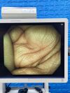 OLYMPUS Scope  Model: PCF-H290DL Colonoscope