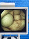 OLYMPUS Scope Model: PCF-H290DL Colonoscope