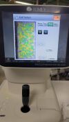 TOMEY EM-4000 Specular Microscope
