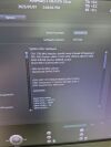 GE Voluson S10 Ultrasound - OB / GYN