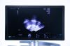 GE HEALTHCARE Voluson E8 BT18 USG Machine