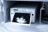 GE HEALTHCARE Voluson E8 BT18 USG Machine