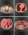GE Discovery* 690 PET/CT