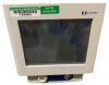 ASPECT MEDICAL S INC 185-0151 Monitor
