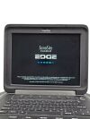 SONOSITE P15000-63 EDGE PORTABLE ULTRASOUND SYSTEM W/ 2 PROBES