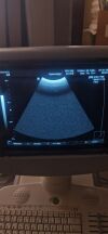 MEDISON C3-7ED Ultrasound Transducer