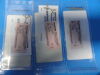 SYNTHES 421.021 Lot of 80 Synthes Titanium CMF Fixation Plates – Orbital, Zygomatic, MatrixNeuro, L-, Y-, T-, X-, H-, Mesh Plates