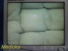 STRYKER ENDOSCOPY Stryker 21" Vision Elect Flat Panel, 240-030-930 W/ Power Supply ~ Monitor