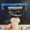 PHILIPS Used  IU22 Convex Linear Linear 3 Probes Ultrasound Unit
